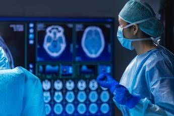 Gemelli siamesi neurochirurgo Giussani Con gli avatar separazioni piu precise e sicure