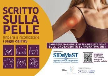 Idrosadenite suppurativa al via campagna di sensibilizzazione Scritto sulla pelle