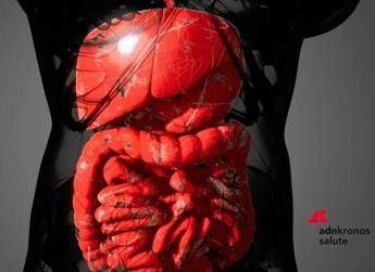 Malattie infiammatorie intestinali rimborsabile guselkumab per colite ulcerosa e Crohn