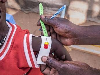 Save the Children bambino su sotto i anni nel mondo soffre di grave poverta alimentare